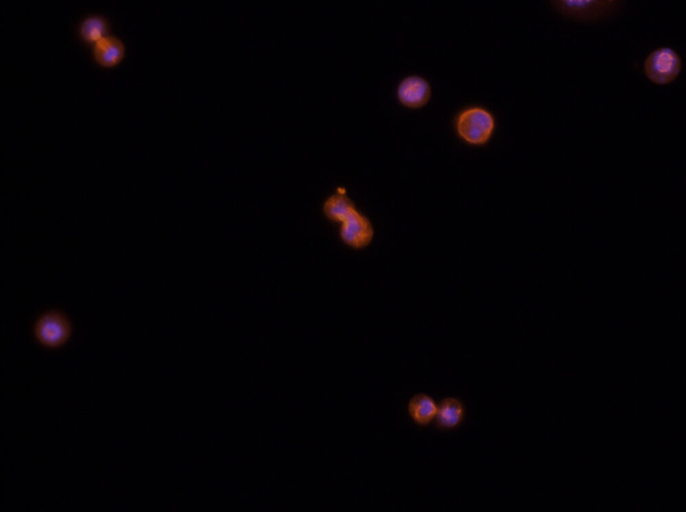 Screenshots aus den Mikroskop-Beobachtungen der Zellteilungen. Hier die Ana-Phase