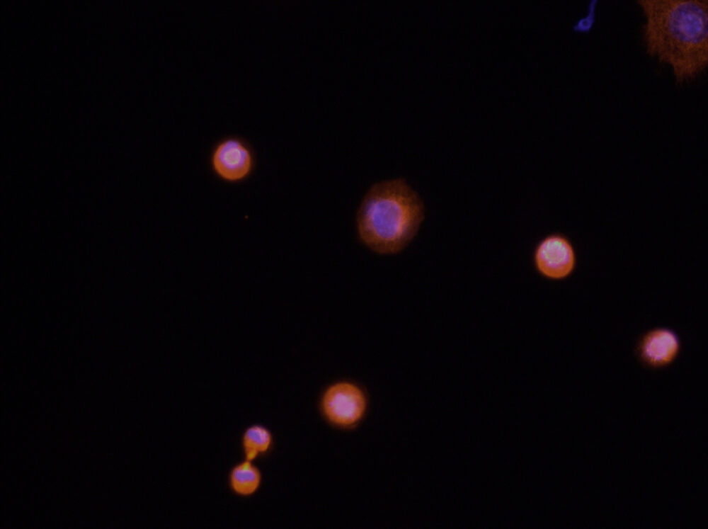 Screenshots aus den Mikroskop-Beobachtungen der Zellteilungen. Hier die Pro-Phase
