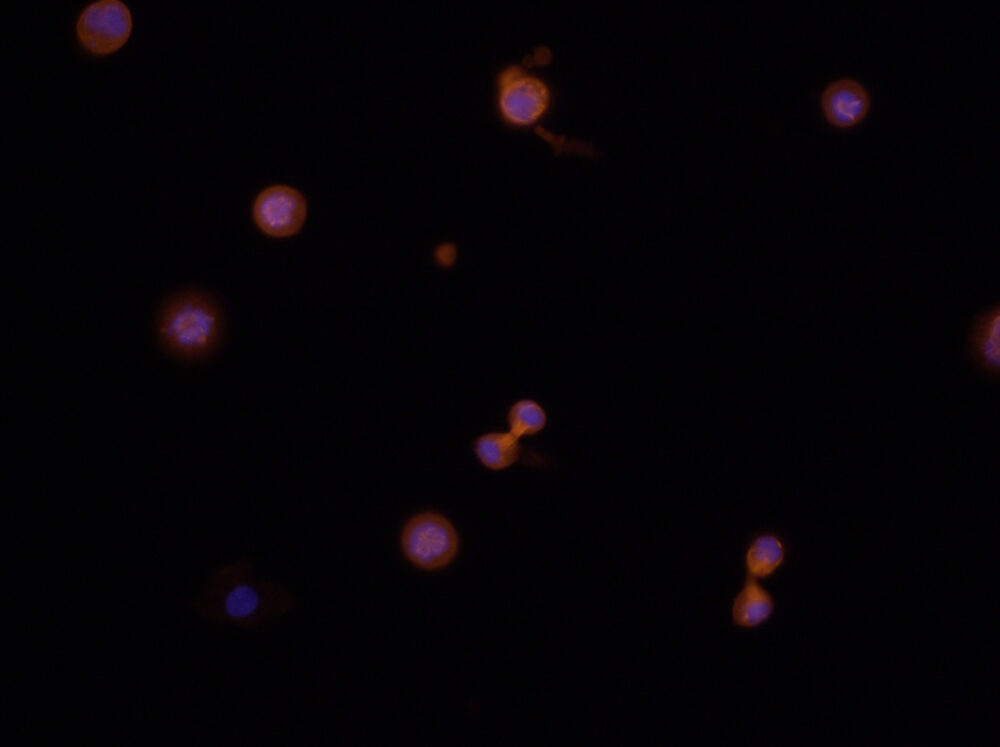 Screenshots aus den Mikroskop-Beobachtungen der Zellteilungen. Hier die Telo-Phase