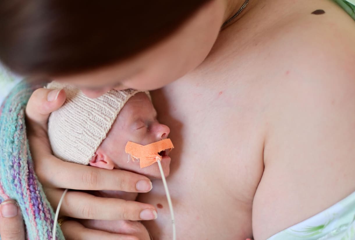 Das Foto fängt einen ergreifenden und entscheidenden Moment ein: Eine Mutter hält ihr Frühchen Haut an Haut. Das Baby wird sanft gegen die Brust der Mutter gedrückt, ohne dass Kleidung dazwischen ist, was dabei hilft, eine tiefe Bindung zwischen ihnen aufzubauen. Diese Methode ist auch als „Känguru-Pflege“ bekannt und trägt zu einer besseren Entwicklung und dem Überleben des Kindes bei, insbesondere bei Frühgeburten.