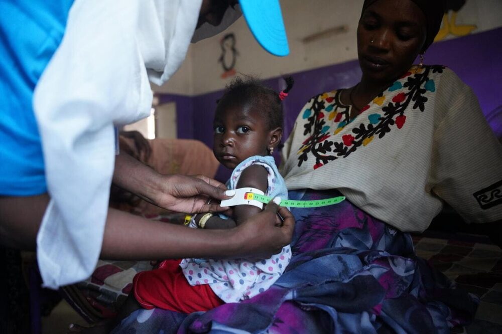 Am 3. Juli wird die zweijährige Fatima von Yousra Mohammed, UNICEF-Ernährungsbeauftragte im Wad Madani Kinderkrankenhaus, auf Unterernährung untersucht. Ihre Familie wurde aus der Region um den Blauen Nil vertrieben