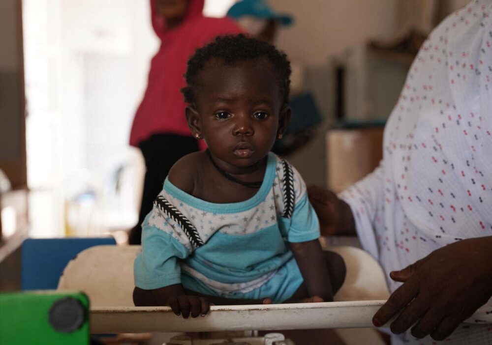 Am 4. Juli wird die 9 Monate alte Nasra beim wöchentlichen Nachuntersuchungsbesuch in der Gesundheitseinrichtung auf Unterernährung untersucht. „Seit sie vor zwei Wochen mit der Behandlung begonnen hat, hat sich ihr Zustand verbessert.“