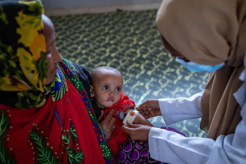 Die 8 Monate alte Latu Doyo wird im Dubuluk Gesundheitszentrum in Äthiopien wegen schwerer akuter Unterernährung behandelt und erholt sich gut.