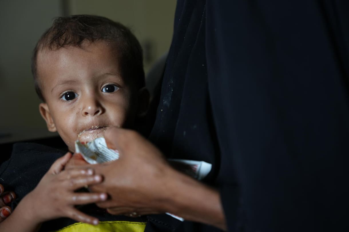 Ishraqs Sohn bekommt bei einer der regelmäßigen Untersuchungen im Gesundheitszentrum im Dorf Al-Khatabiah (Lahj, Jemen) auch kräftigende Nahrung.